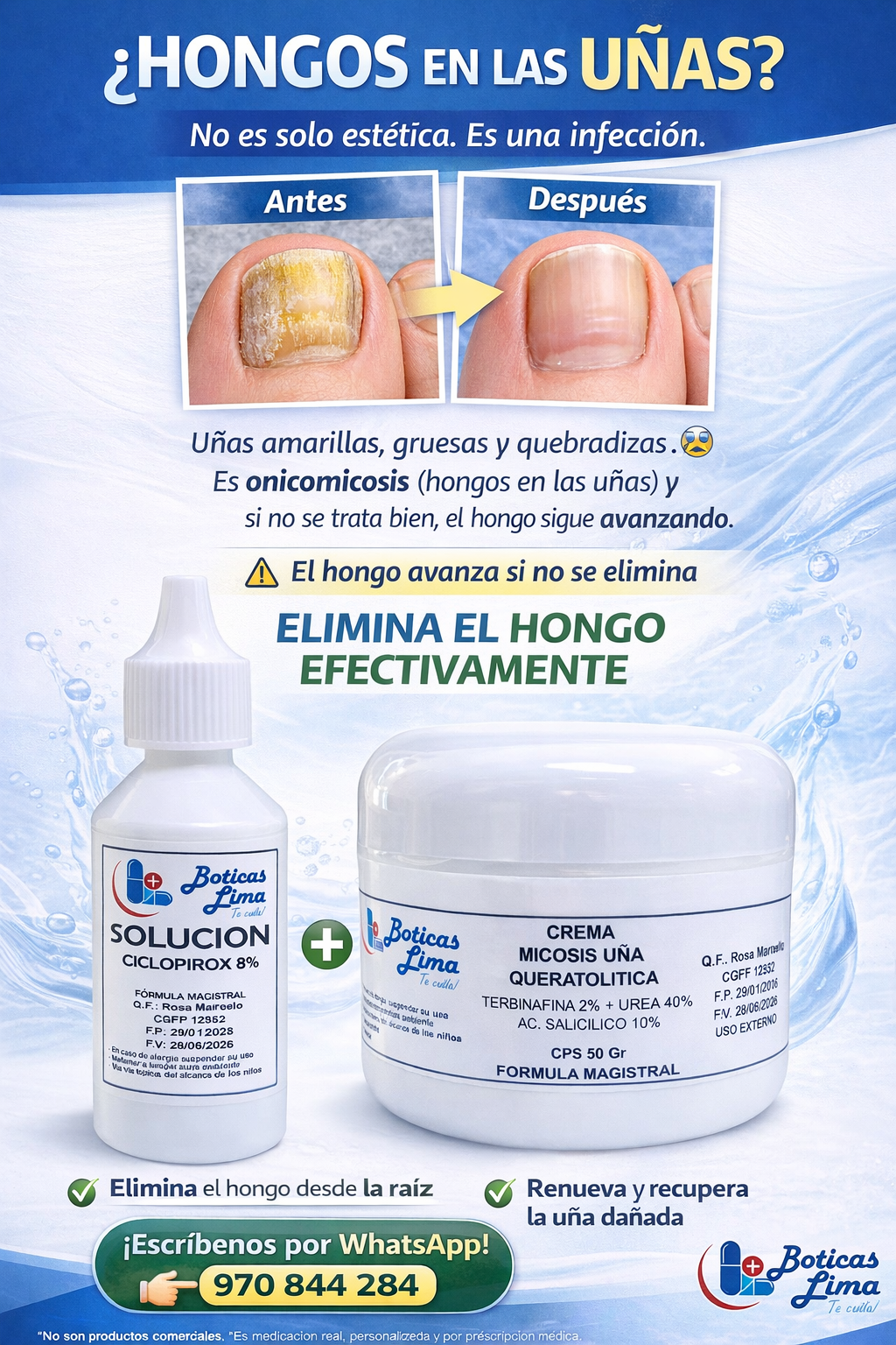 Tratamiento Completo para Hongos en las Uñas (Onicomicosis) – Fórmula Magistral